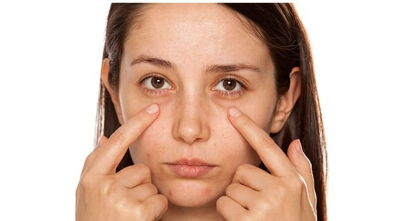 These Home-made Tips will Help you get rid of Dark Circles Quickly