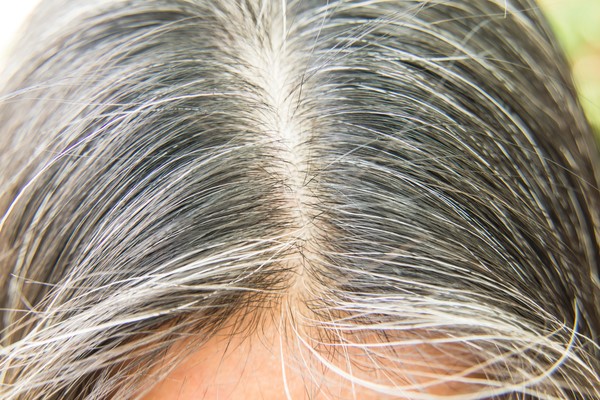 Treatment of white hair, remedy for gray hair at an early age